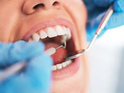 Dental Checklist Photo